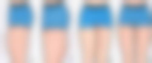 上海愉悦薇莱医疗美容医院:项目价格及性价比分析