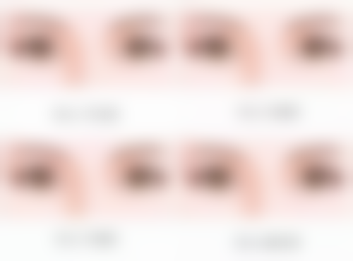 杭州艺星整形医院优惠活动与真实实例分享