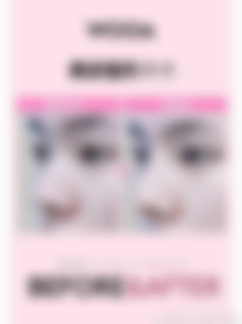 宁波雅韩龚涛医生修复鼻子技术好吗？技术靠谱审美在线，众多患者术后反馈超满意 