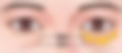 北京碧莲盛植发技术解析