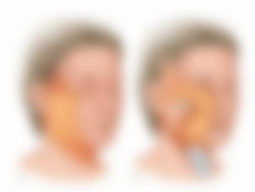 北京碧莲盛植发价格体系