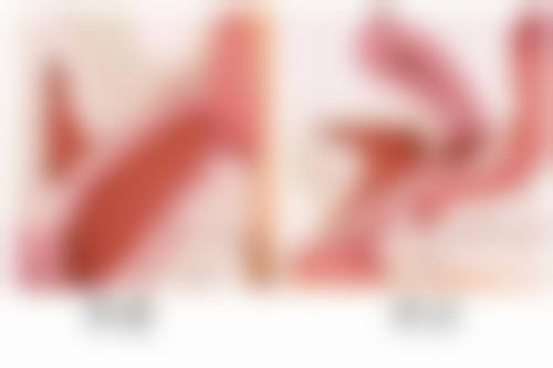 上海铂诗玥医美价格表来啦！涵盖多种热门项目，让你清楚了解医美消费情况 