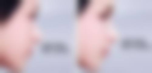 上海艺星整形医院收费总结