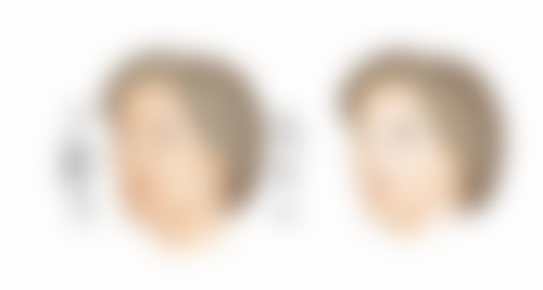 郑州有美医疗美容:杜绝假冒产品