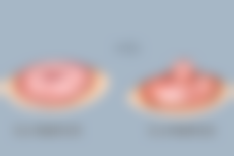 联合丽格第一医疗美容医院:袁强博士的专精实力