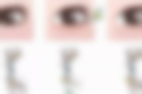 四川达州绮云口腔医院2025年牙齿矫正项目详解