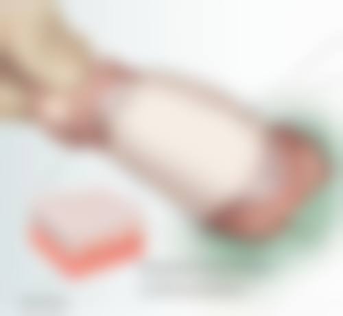 昆明昆大疤痕医院的收费情况如何?