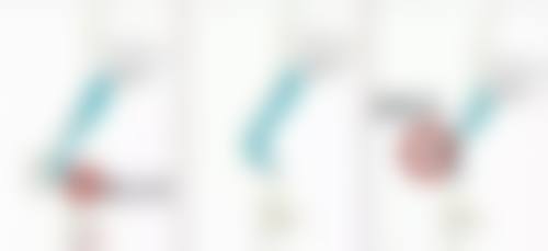 上海眼睛修复魏少魁怎么样？真实案例揭秘，技术靠谱经验丰富好评多！ 