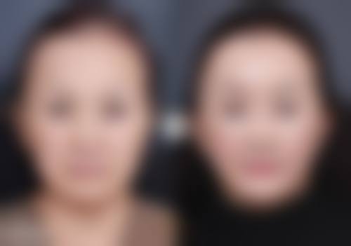 长春赫蒂医疗美容门诊部部分热门项目价格表