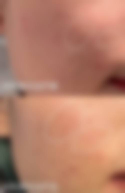 总结：梅州曙光整形医院值得选择！