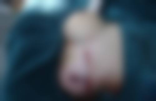 上饶尚美整形医疗美容医院价格表来啦！涵盖多种热门医美项目，让你消费明明白白 