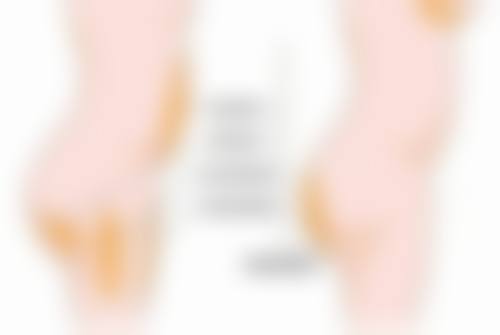 广州军美整形医院吸脂和其他项目价格