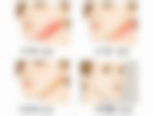 扬州艺星美医疗美容门诊部是不是正规医院？有资质认证且医生经验足，可放心去！ 