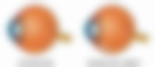 上海愉悦薇莱医疗美容医院陈红梅医生真实口碑大曝光