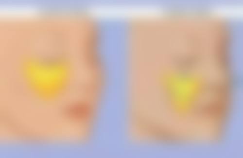 广州军美整形医院收费价目表公布！涵盖常见整形项目，价格透明合理让你心中有数 