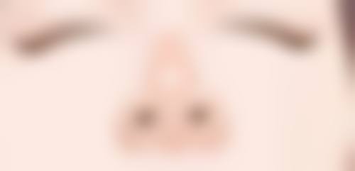 上饶尚美整形医疗美容医院特色项目实例展示