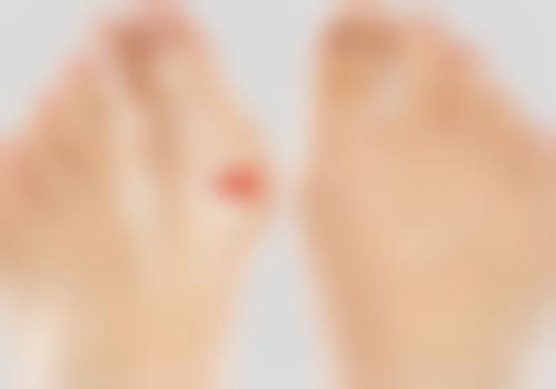 成都美茵医疗美容：祛眼袋的专精之选