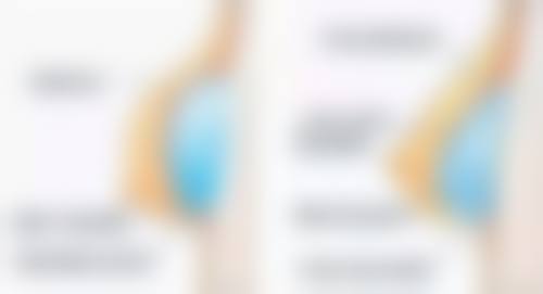 北京俊泰美好医疗美容门诊怎么样？正规靠谱，医生技术好，术后效果自然，口碑还不错！ 