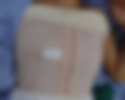 深圳南雅医疗美容门诊部项目价格