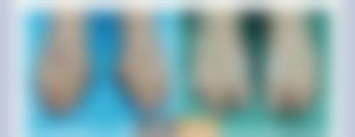 湖州天伊医疗美容门诊部：优势项目大放送