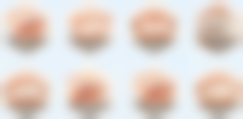 上海艺星医疗美容医院的热门项目