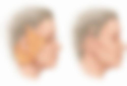 深圳南雅医疗美容门诊部擅长项目