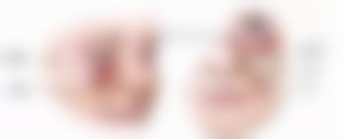 湖州天伊医疗美容门诊部公交怎么坐？别愁，这篇攻略给你讲明白乘坐路线！ 