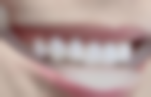 大连爱德丽格医疗美容门诊部是不是正规医院？是正规的，资质靠谱项目全还受不少人认可