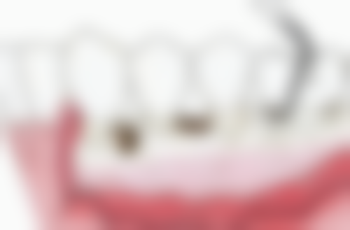 南京美贝尔美容医院的优惠活动