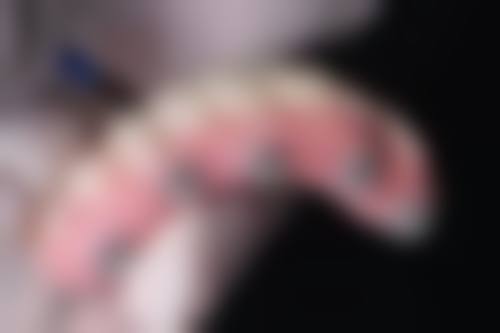 南京美贝尔美容医院收费标准怎么样？性价比高且项目丰富，值得来了解下 