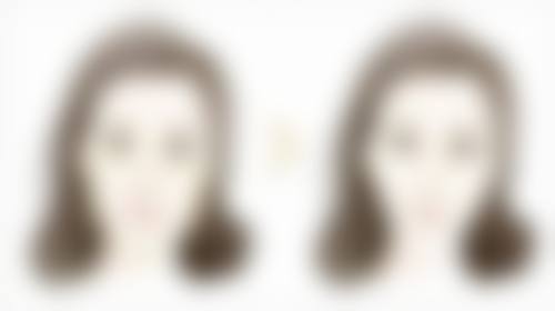 北京艺星医疗美容医院的收费价格