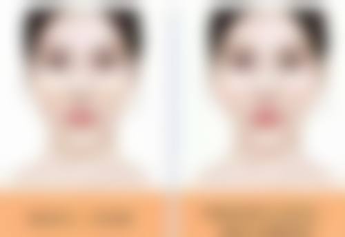 总结：北京艺星医疗美容医院收费实惠不吃亏