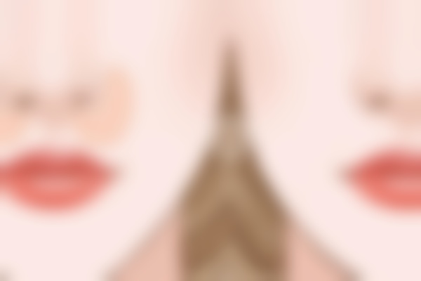 广州曙光医疗美容医院蒋思军隆鼻怎么样？20年经验医生打造自然妈生鼻，附2026价格参考