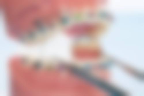 上海艺星医疗美容医院微整注射价格