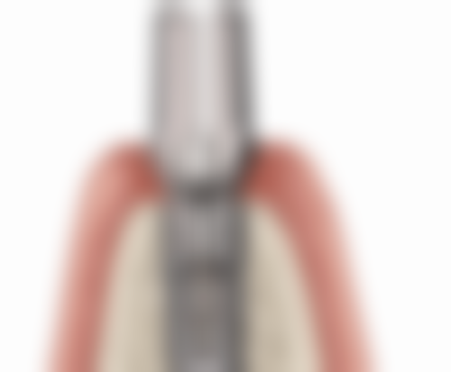 上海艺星医疗美容医院价格表来啦！涵盖多种医美项目，价格合理助你变美无忧 