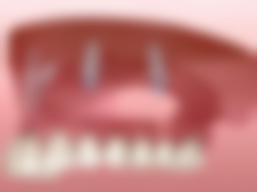 成都军大整形美容医院的价格与实例见证