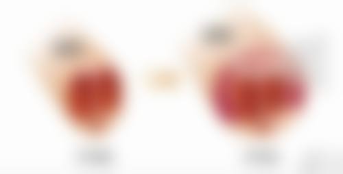 广州穗华口腔医院基础治疗收费情况