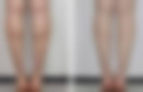 辽宁沈阳德立联合口腔医院的收费情况如何？