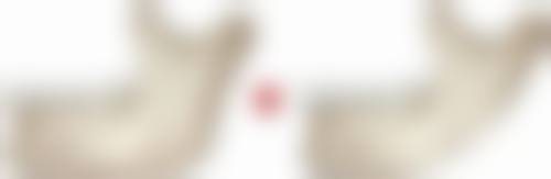 沈阳德立联合口腔医院综合科项目价格