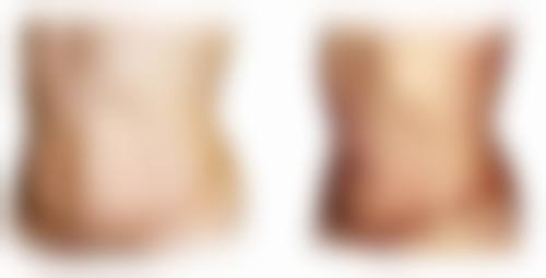 长沙雅贝康口腔医院口碑与服务评价