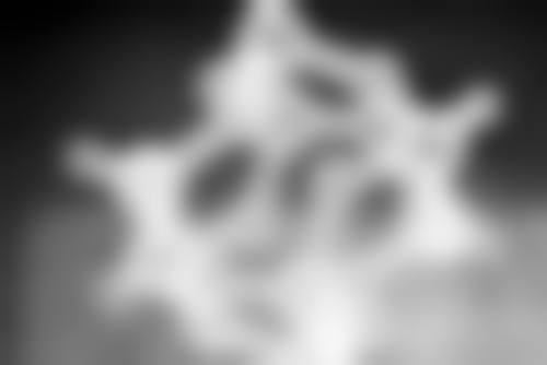 馒化针打3天，面部轮廓悄然改善