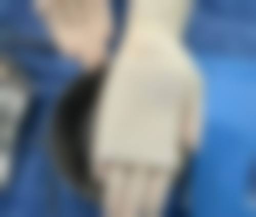 男性健康医院在线咨询：担心男科手术风险大？重庆星荣/上海九龙等医院24h免费解疑，隐私有保障！