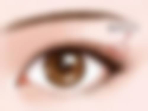 4000 - 6000元起，馒化针重塑精致轮廓