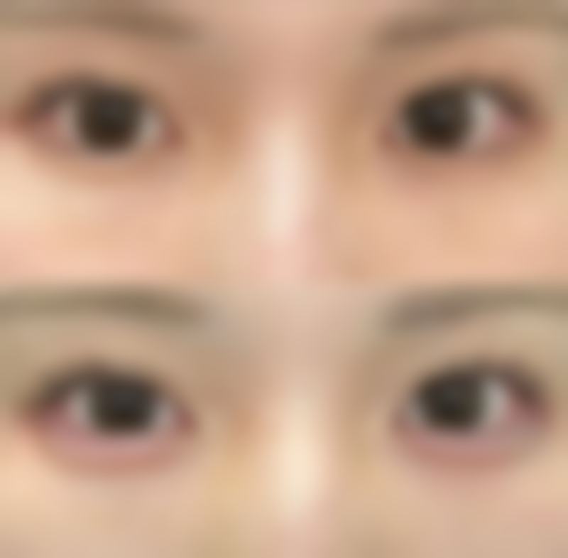 成都素美整形嗨体2.5水光项目推荐医生及技术优势