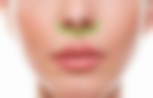 深圳福雅医疗做人中缩短的技术特点有哪些？