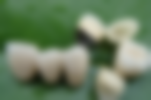 汕尾市健锋口腔诊所详细的预约挂号方式及流程