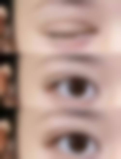 李龙梅医生技术优势