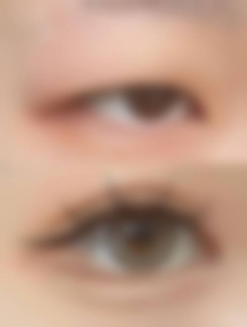 李龙梅医生口碑评价及真人实例