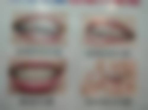 宁安市杜小甫口腔诊所收费价格表/收费标准