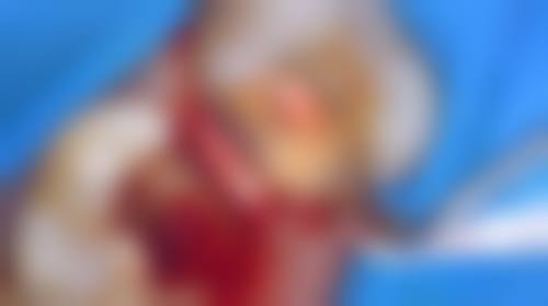 盐城唐雪梅中意口腔特色项目及技术优势